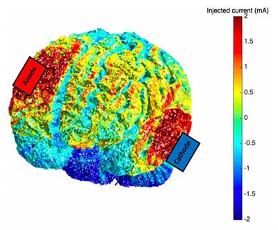 Predicting Working Memory Training Benefits From Transcranial Direct Current Stimulation Using Resting-State fMRI